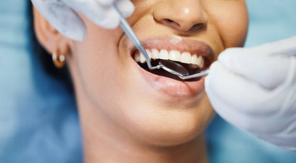 Best Knocked-Out Tooth Emergency  in Baldwyn, MS