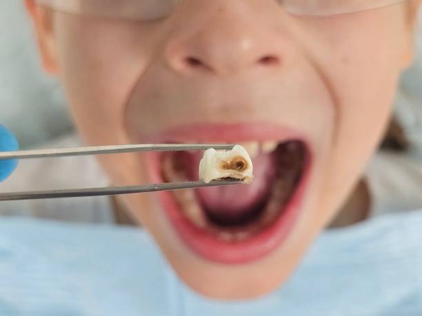 Best Affordable Emergency Dental Care  in Baldwyn, MS