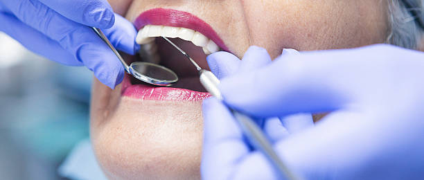 Best Chipped Tooth Repair Near Me  in Baldwyn, MS